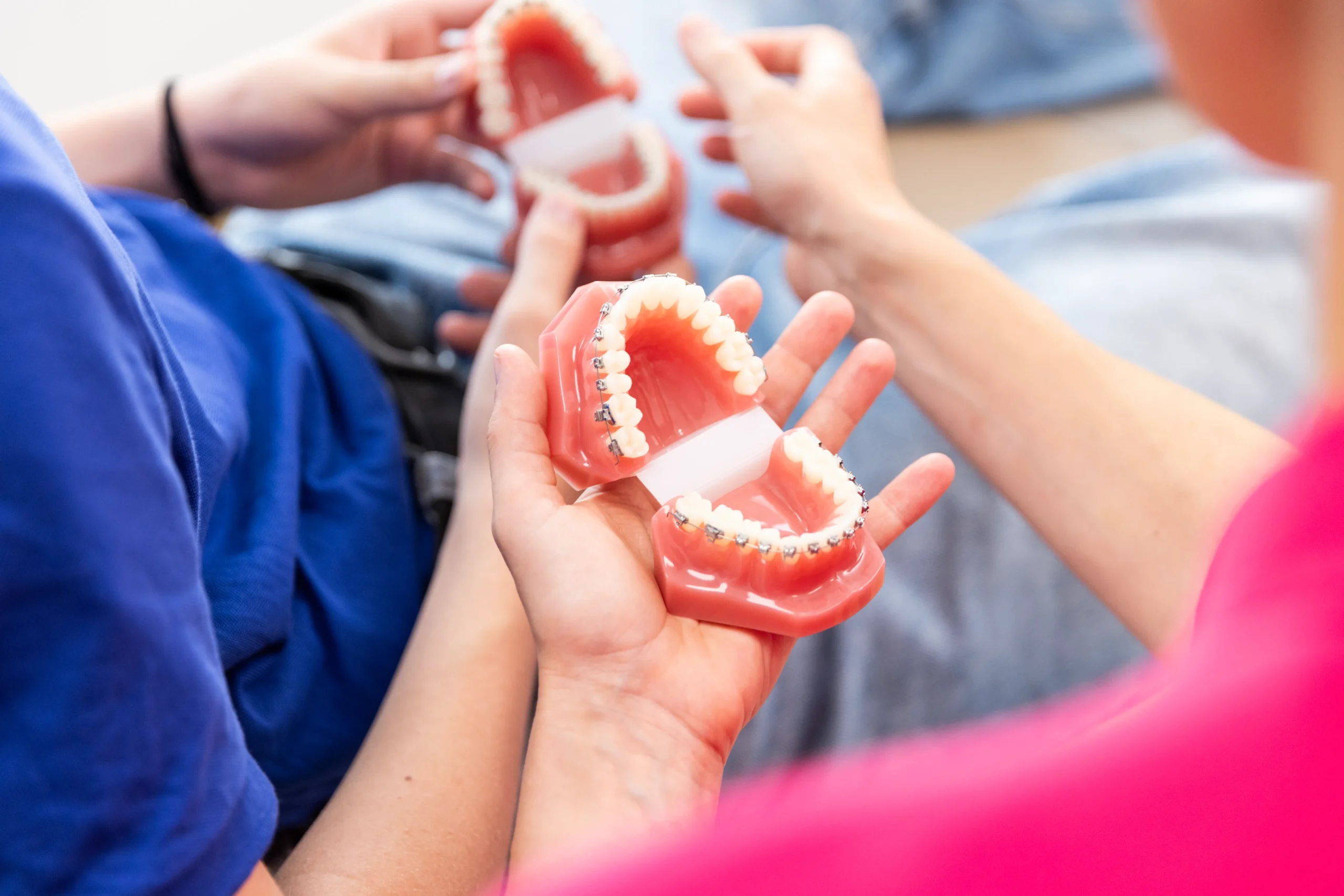Demo-Zahnmodelle von klassischer Metallzahnspange, Keramikspange, innenliegender festen Zahnspange, sogenannter Lingualtechnik, werden gezeigt.