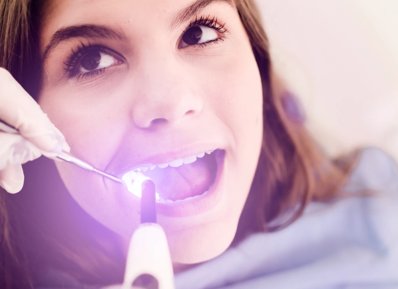 Glattflächenversiegelung